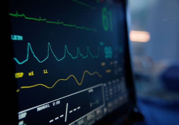 ECG